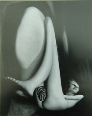 Distortion